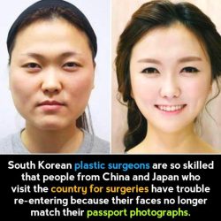 South Korea plastic surgeons